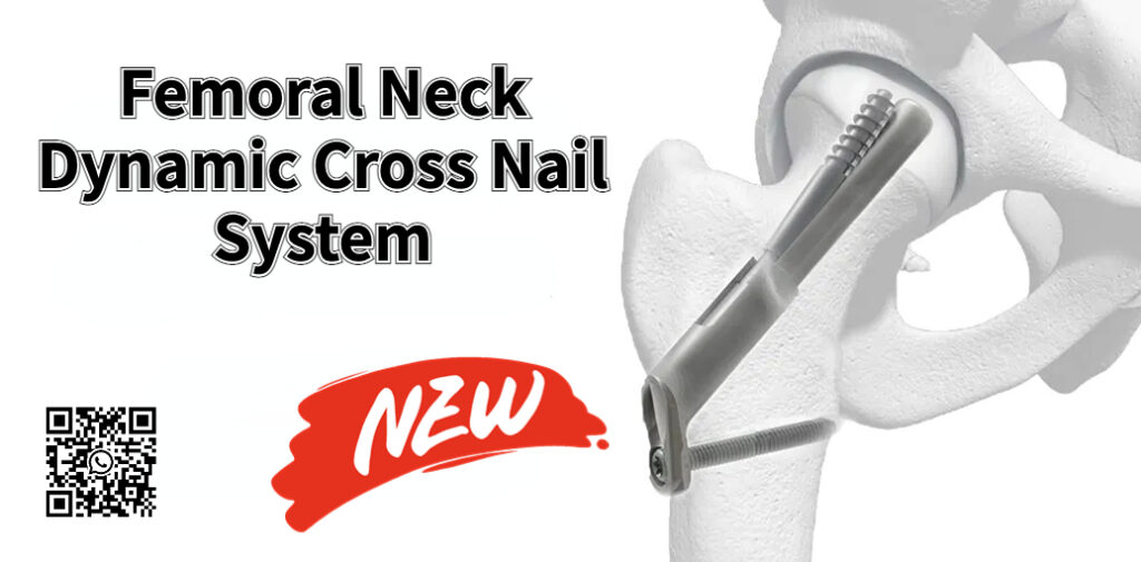 Femoral Neck Dynamic Cross Nail System Product Introduction