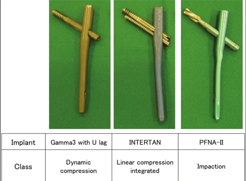 PFNA, InterTAN, or Gamma3,