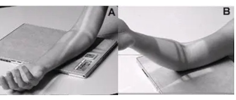 X-ray projection methods and patient positioning diagram